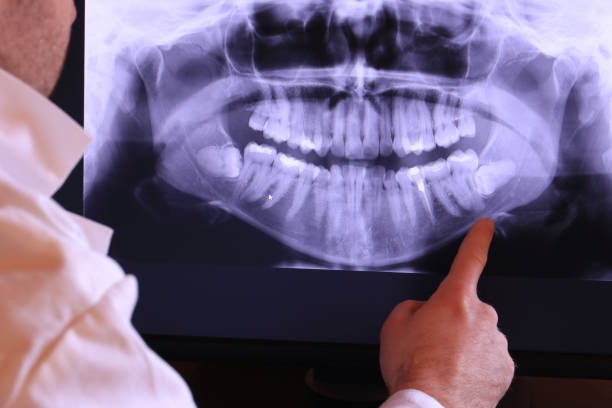 Best Emergency Care for Gum Disease in Vergennes, VT